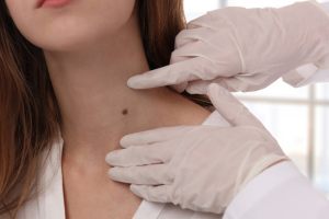 dermatologie la Ambulator Clinic Europa Timisoara